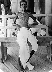 World War 1 Picture - An Indian soldier after siege of Kut