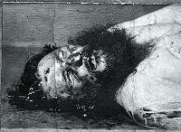 World War 1 Picture - Post-mortem photograph of Rasputin showing the bullet hole in his forehead