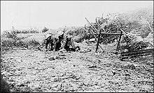 World War 1 Picture - A wounded man of the Newfoundland Regiment is brought in at Beaumont Hamel